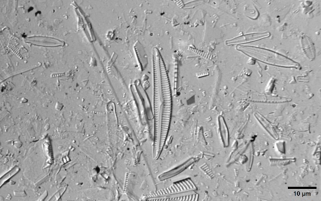 Diatoms in a clean stream (Image Source: Karthik Balasubramaniam)