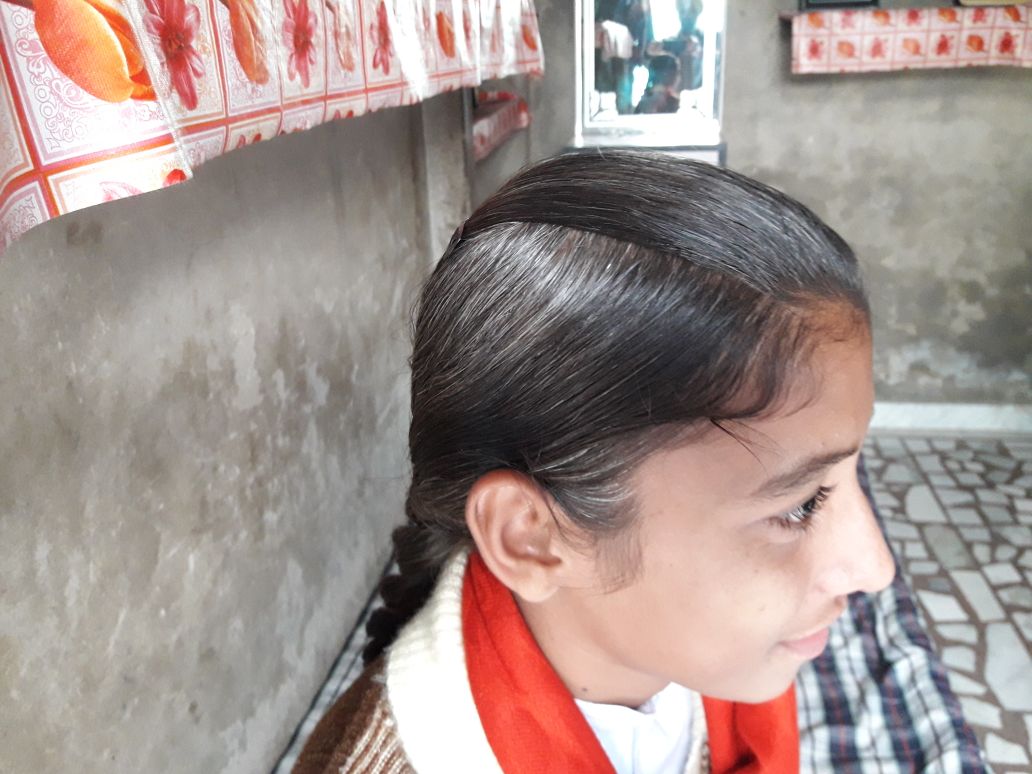 Teenager Ramandeep Kaur's hair has greyed like many other teenagers in her village. (Source: 101Reporters)