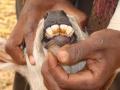 युवक के दाँतों पर हाइड्रो-फ्लोरोसिस का दुष्प्रभाव