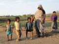 Several young children in Jhabua suffer from skeletal fluorosis (Source: INREM Foundation)