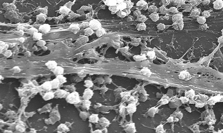 जल प्रदूषण की पर्यावरणीय सफाई में बायोफिल्म बनाने वाले बैक्टीरिया की भूमिका,Pc-hmoob