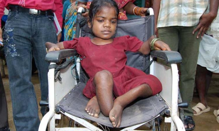 A child having disability. Photo for representation only. (Image Source: IWP Flickr photos)